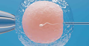 Qual a idade ideal para congelar óvulos? Dra. Taciana Fontes explica e lembra exemplos de famosas que recorreram ao método