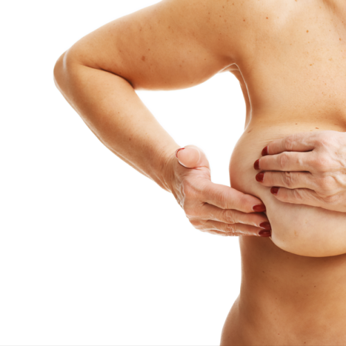 Enfrentamento do câncer de mama requer aplicação  efetiva de leis e de políticas públicas