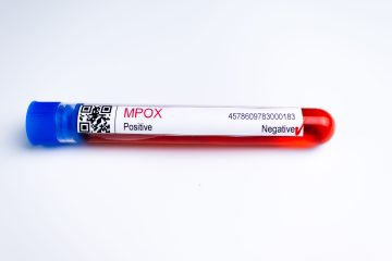 Mpox aumenta no Brasil e reacende alerta para monitoramento e vigilância