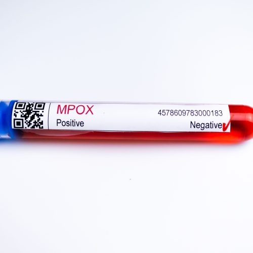 Mpox aumenta no Brasil e reacende alerta para monitoramento e vigilância